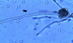 Wet Mount Method for fungi